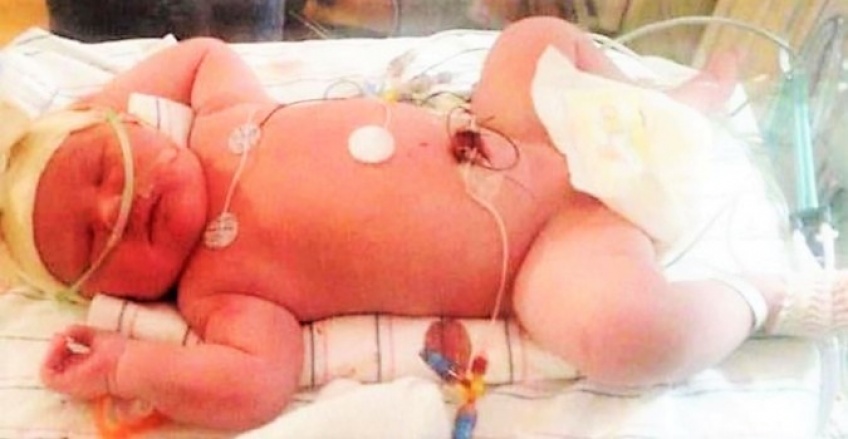 Un Bebe De 7 Kg Est Ne Dans L Etat De New York