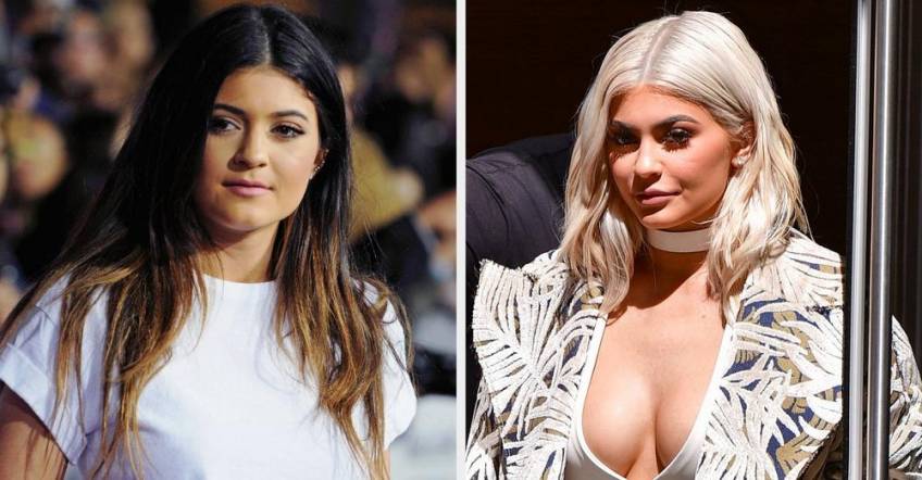 Kylie Jenner Révèle Sêtre Fait Refaire Les Seins à 19 Ans 